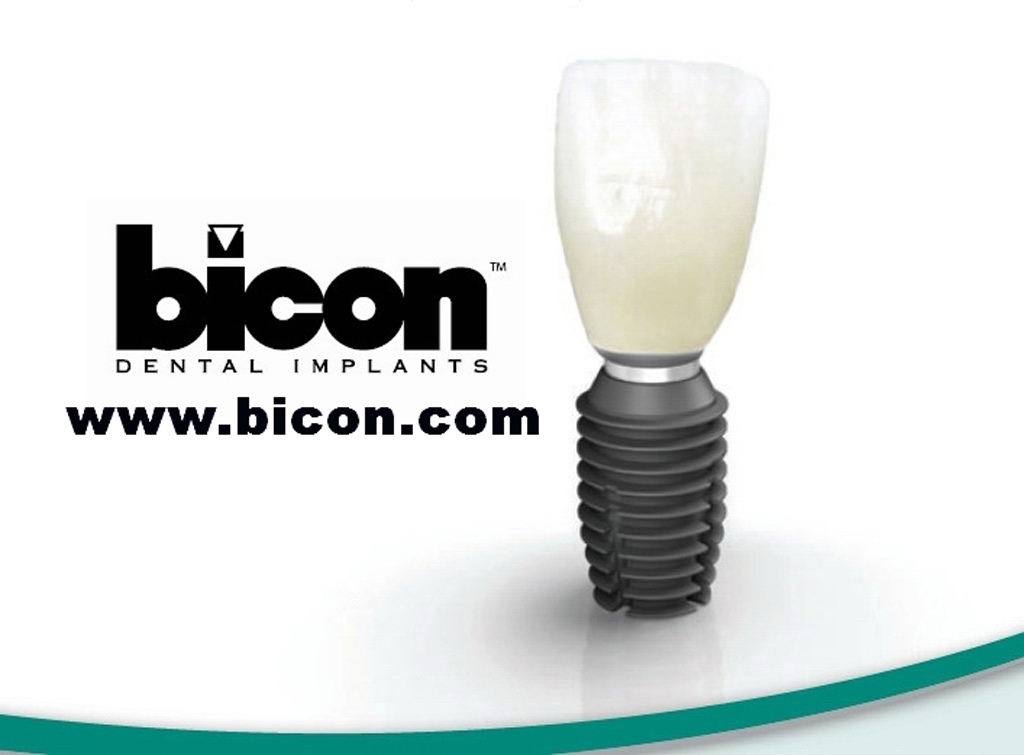 Импланты Bicon: доступные импланты из США