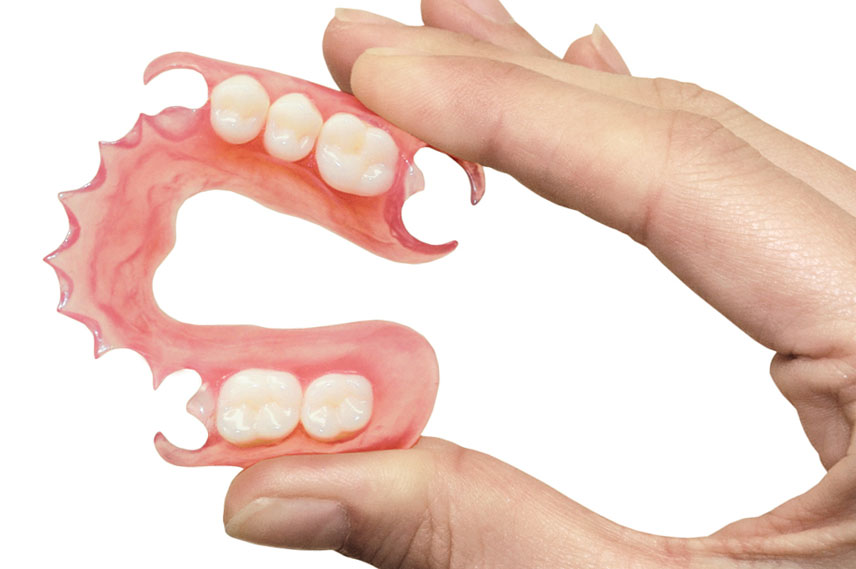 Гибкие зубные протезы: показания к установке.