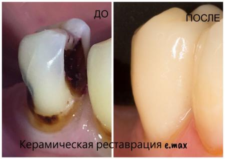 Фотография Ольга 3