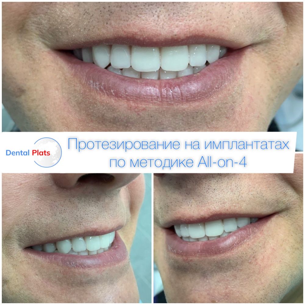 Фотография Дентал Платс 0