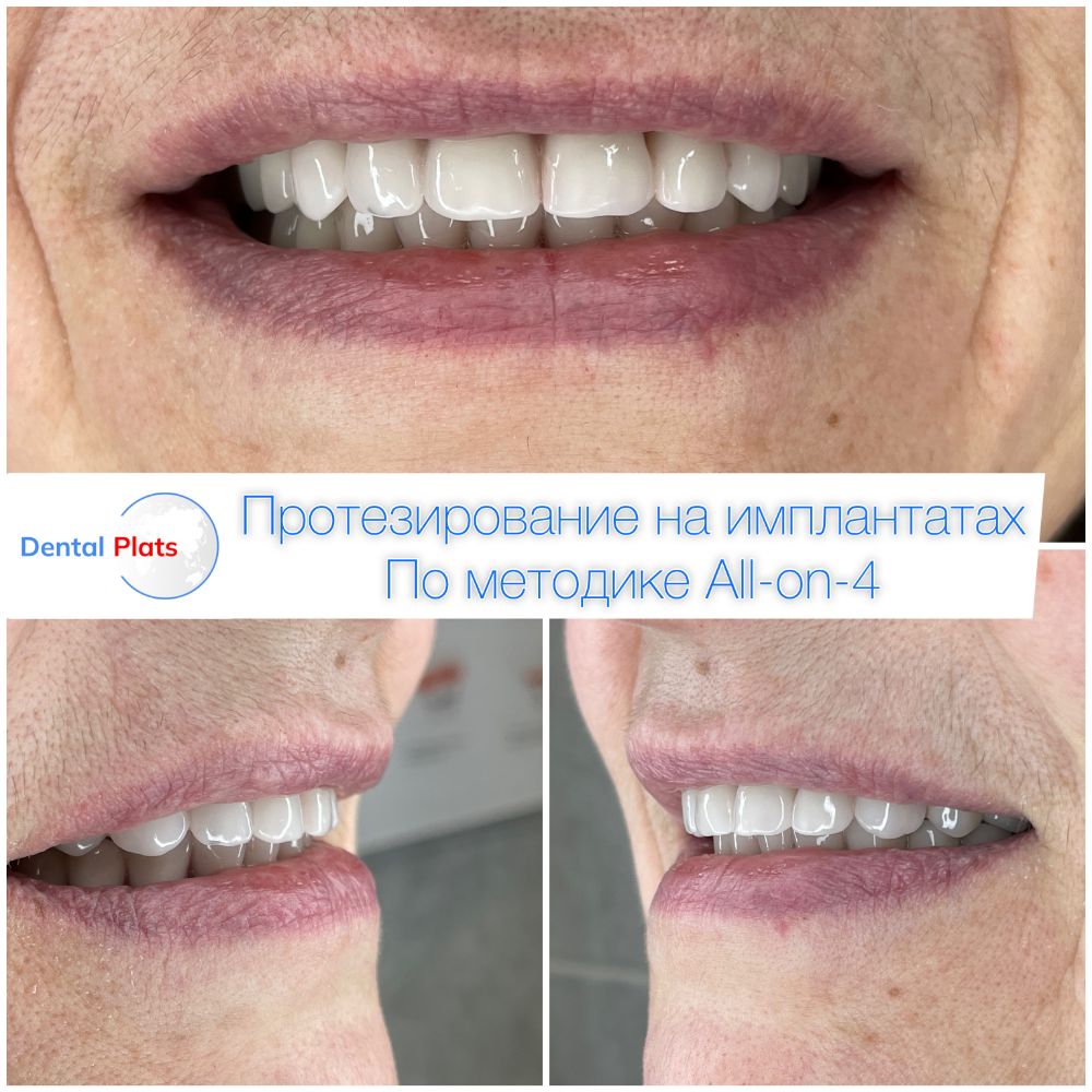 Фотография Дентал Платс 2