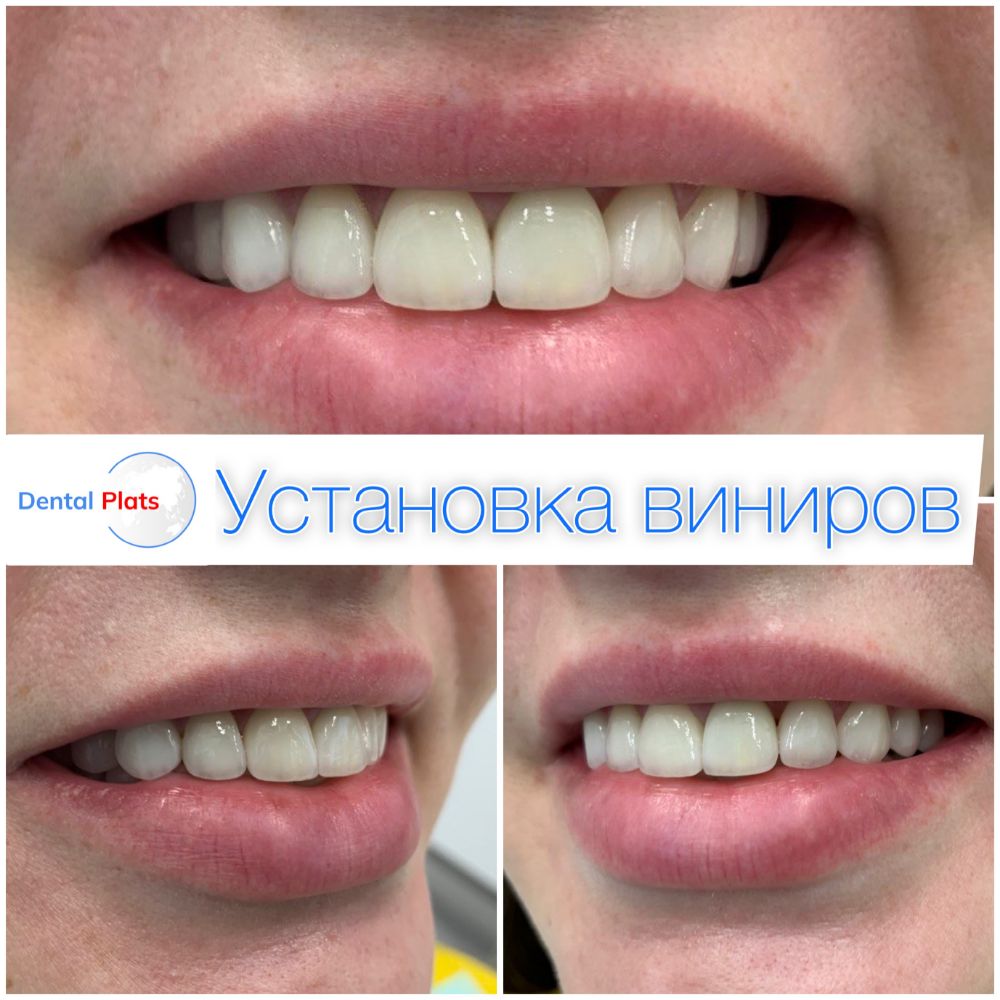 Фотография Дентал Платс 1