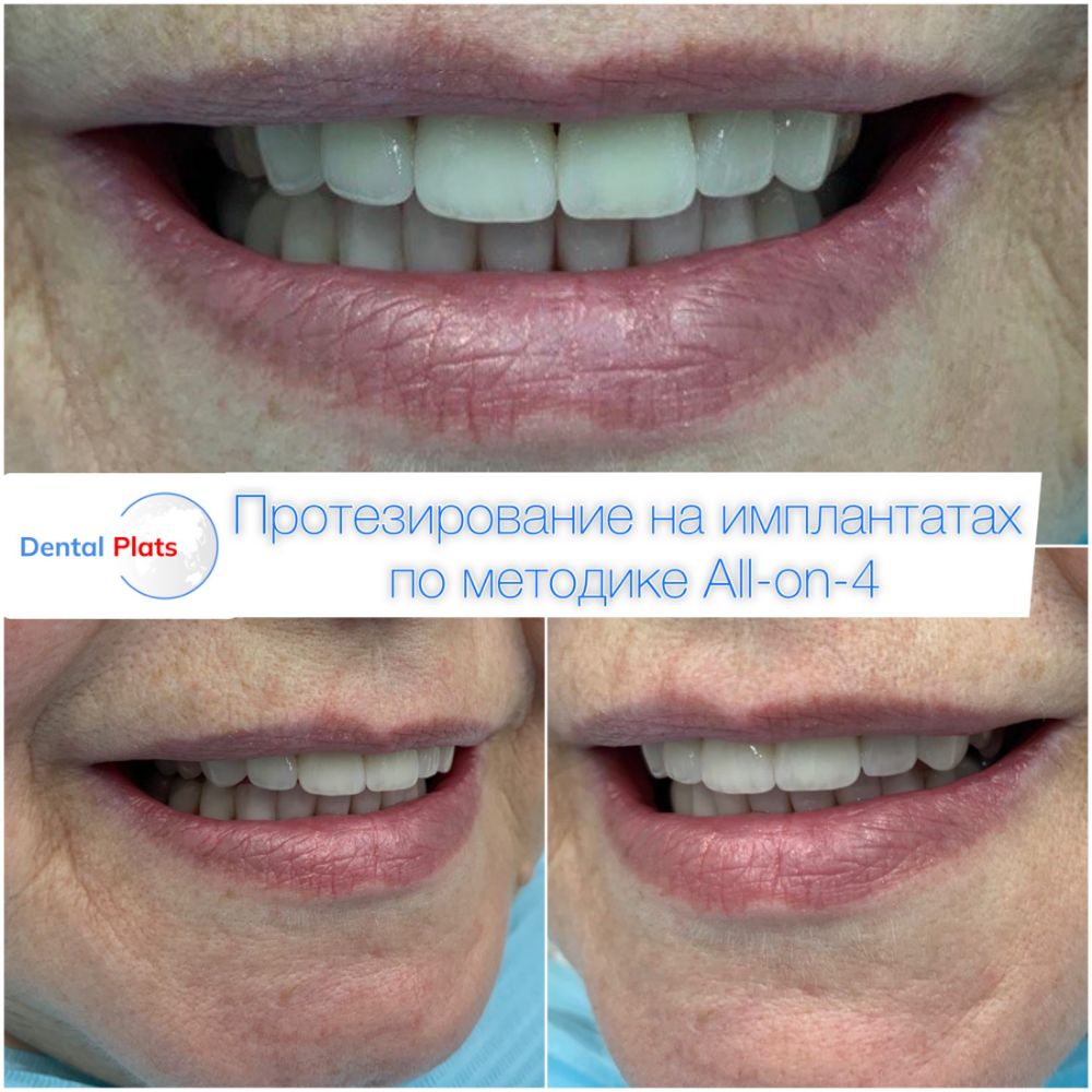 Фотография Дентал Платс 3
