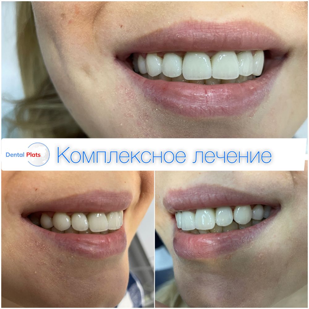 Фотография Дентал Платс 4