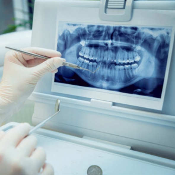 Специальное предложение для новых пациентов.
Бесплатно вместо 2450 руб.