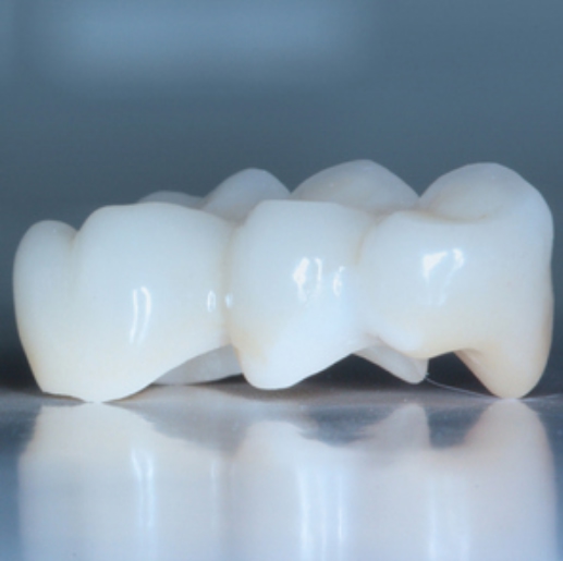 В честь открытия нашего нового филиала в г. Павловске (г. Санкт-Петербург, Пушкинский р-н) мы рады предложить вам скидку 15% на все виды протезирования зубов.