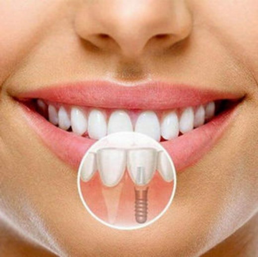 Качественное лечение по выгодной цене: 105 000 руб. вместо 124 000 руб.