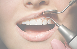 Комплексная чистка зубов со скидкой 30%!
Акция действует  до 31 мая!