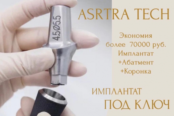 Astra Tech + коронка из циркония технология Prettau (CAD/CAM) — за 99 900 руб вместо 175060 руб