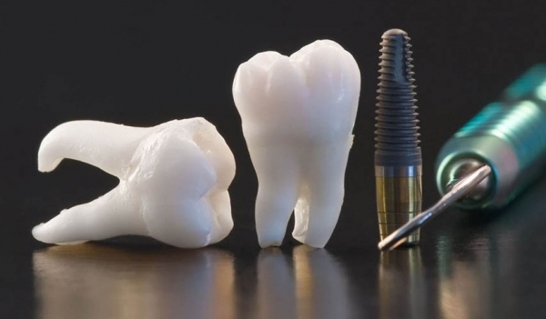 Полное восстановление зубного ряда всего за 260 000 руб.! 
