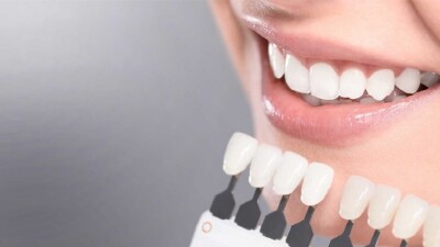 
Кабинетное отбеливание Beyond + профилактическая чистка зубов - 18 000 руб.