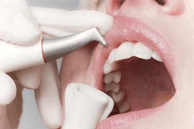 Профессиональная гигиеническая 
чистка зубов - 
всего 2 990 руб.!