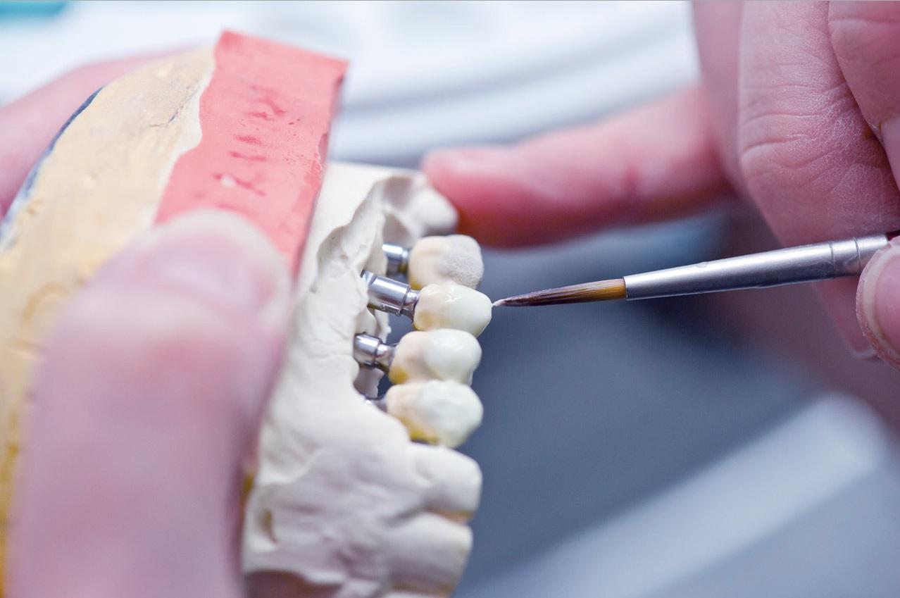 Из какого материала делают импланты зубов?
