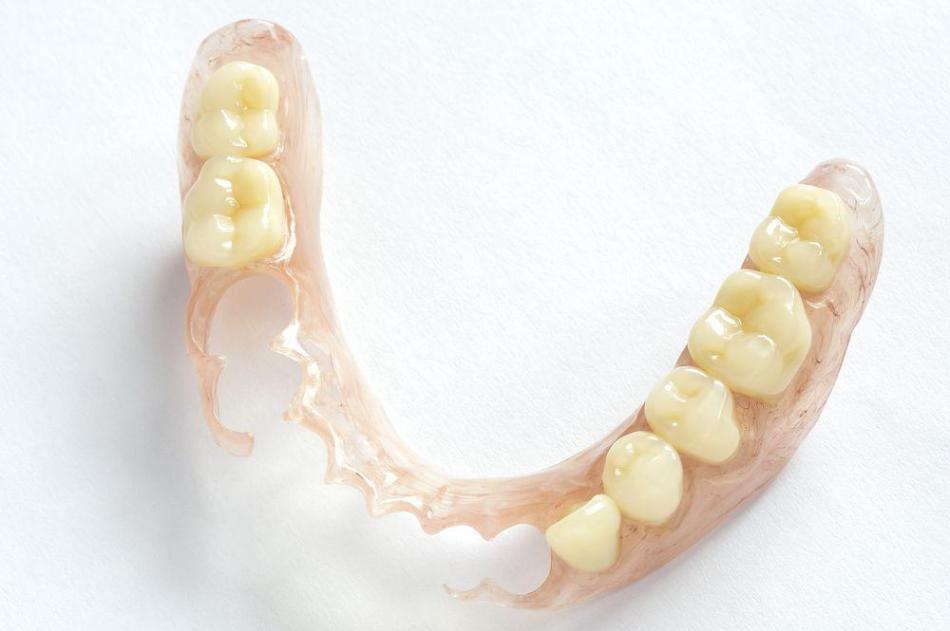 Виды съемных протезов на зубы.