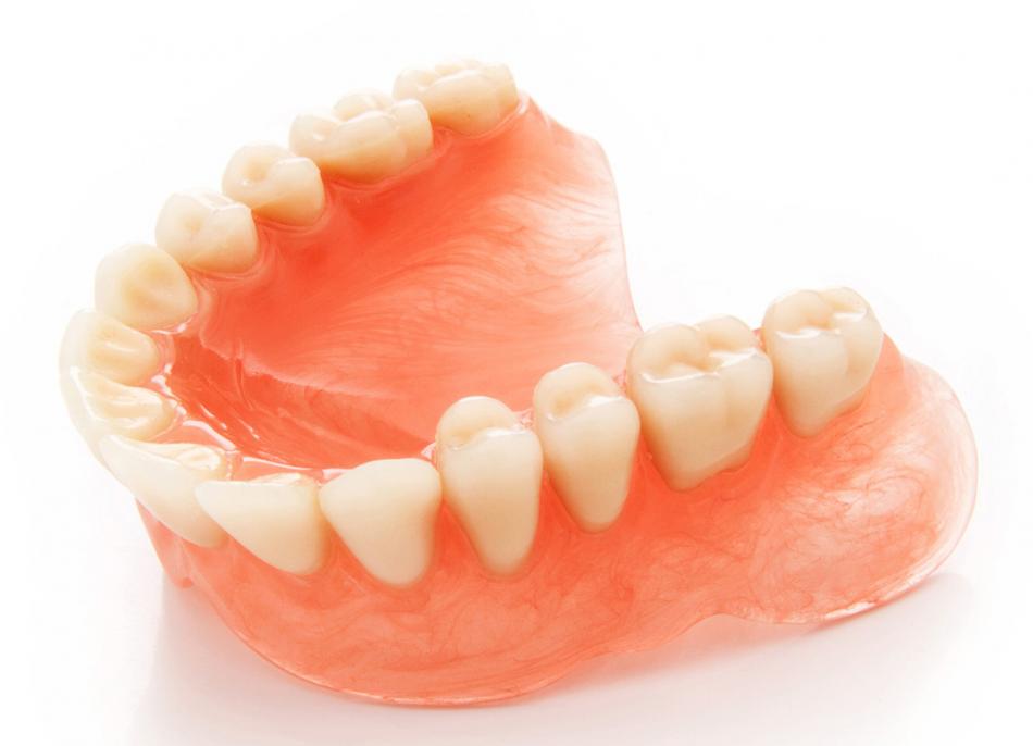 Установка мягких зубных протезов на всю челюсть.