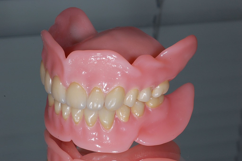 Гибкие зубные протезы: стоимость установки.