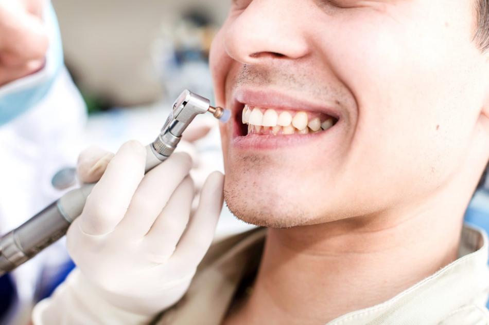 Сколько стоит профессиональная чистка зубов в стоматологии?