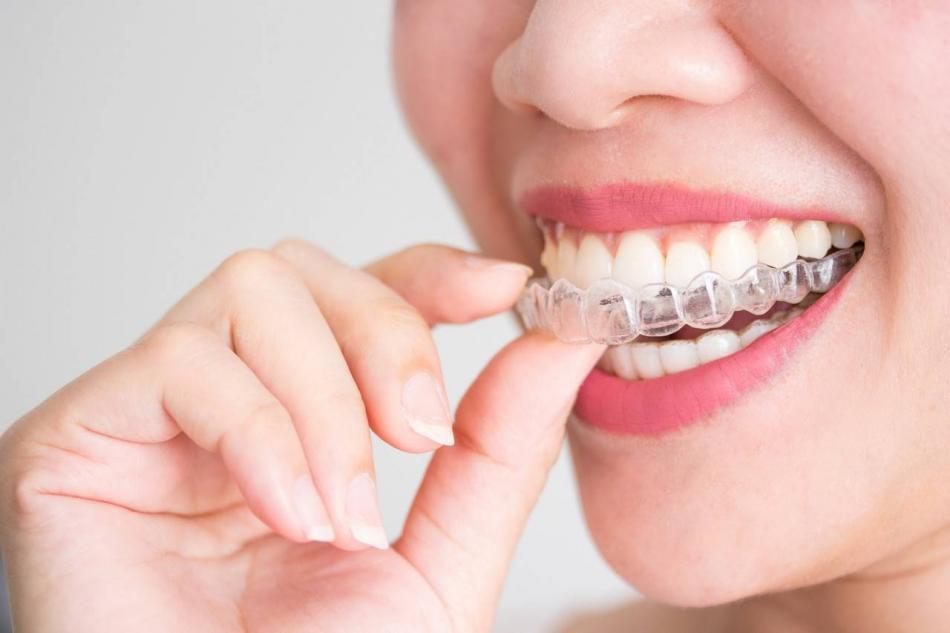 Сколько стоит исправить прикус в стоматологии?