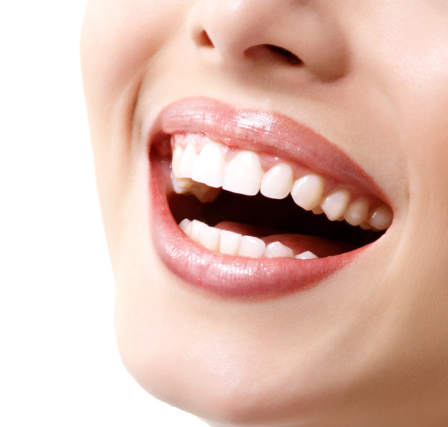Системы профессионального отбеливания зубов в стоматологии.