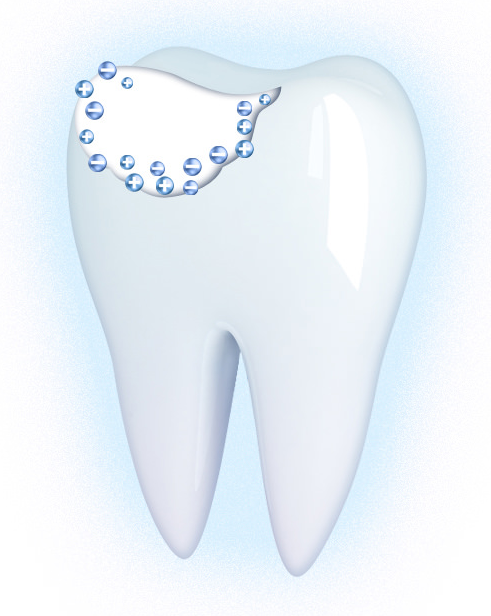 Особенности терапии кариеса молочных зубов у детей.