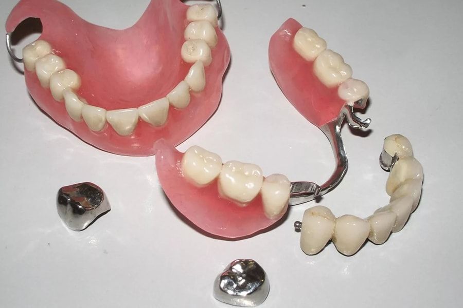 Из чего складывается цена на съемное протезирование зубов.