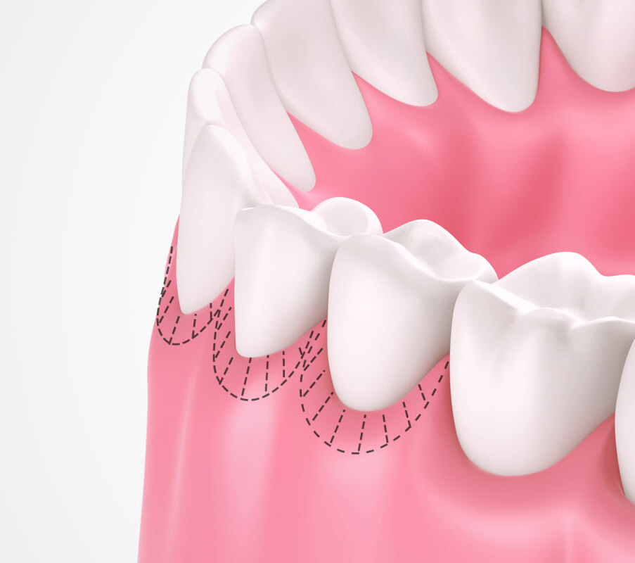 Как лечит и делает операции стоматолог-хирург?