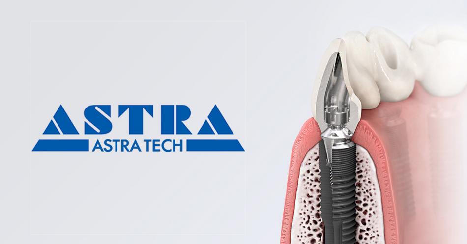 Импланты Astra Tech