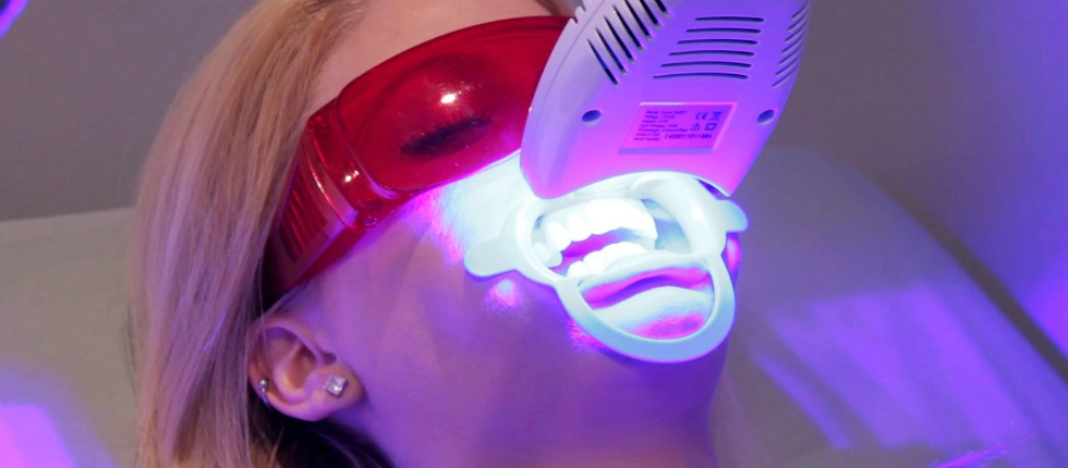 Холодное отбеливание Beyond: показания к осветлению зубов.