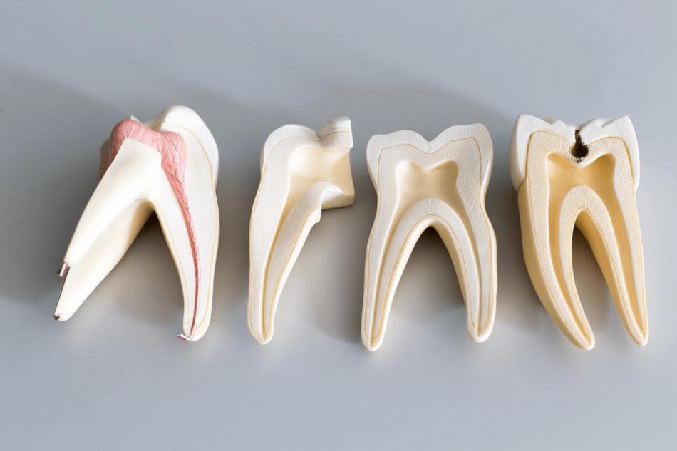 Стоимость гемисекция корня зуба в стоматологии.