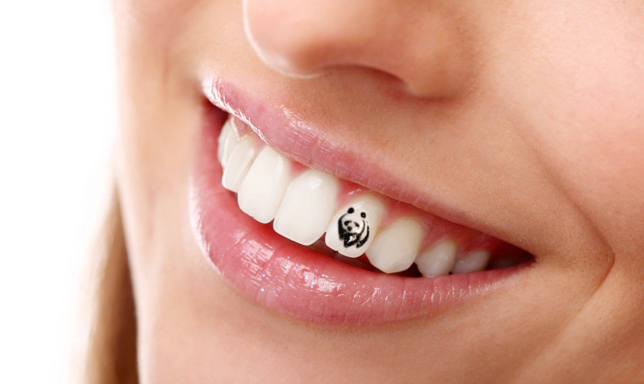 Сколько стоит поставить украшение на зуб?
