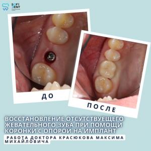 Фотография СофиДент 3