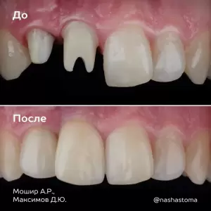 Фотография НС Мед 0