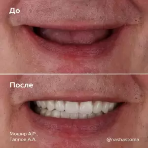 Фотография НС Мед 3