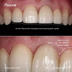 Фотография НС Мед 2