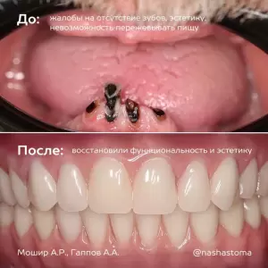 Фотография НС Мед 1