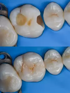 Фотография New Line Dent 5